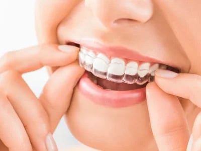 Der Zahnarzt Ihres Vertrauens: Wie Invisalign die Zahnstellungskorrektur verändert