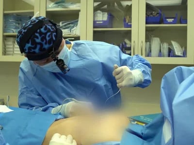 Die ästhetischen Vorteile der Brustvergrößerung mit Eigenfett