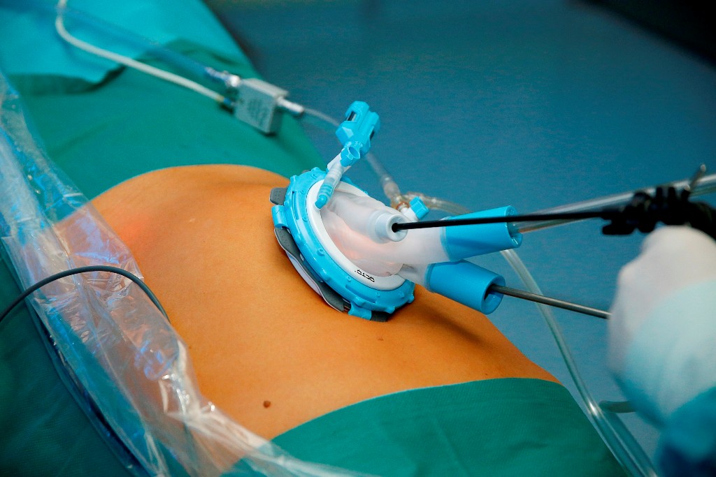 Warum immer mehr Patienten eine Magenverkleinerung Türkei wählen